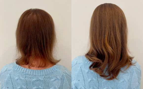 dun haar